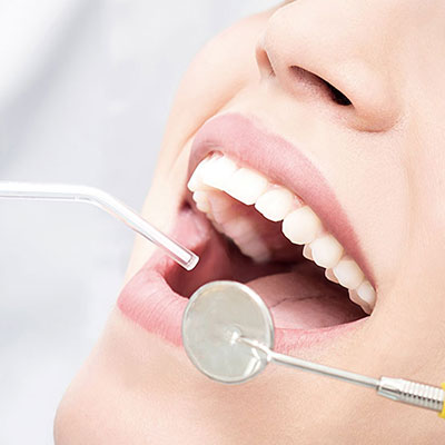 Igiene orale e Prevenzione